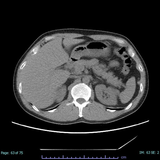 頭頸部のCT・MRI 胸部のCT 腹部のCT 肝胆膵のCT 急性腹症のCTセット-