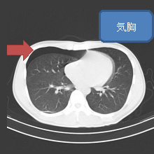 胸部CT検査 | 呼吸器の検査 | 各検査を知る | 人間ドック | 健診会